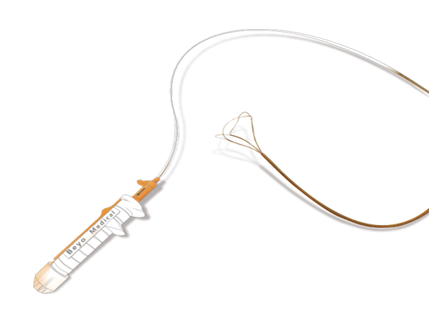 Disposable Endoscopic Stone Retrieval Basket